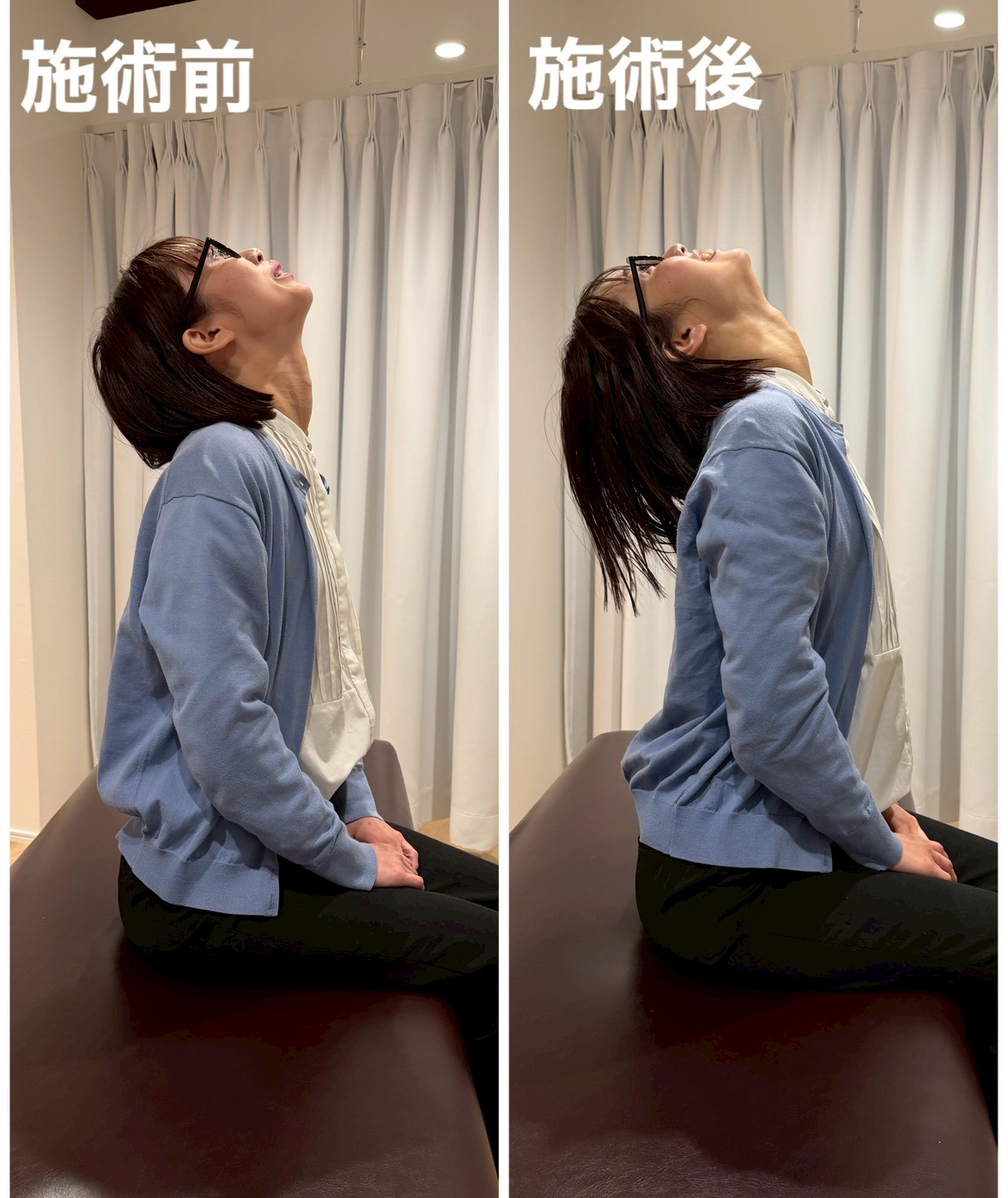 首こり・肩こり改善のビフォーアフター